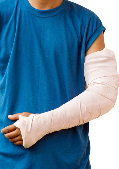 鹿茸加虾青素保健品，用于肘关节损伤，手臂骨折和骨折